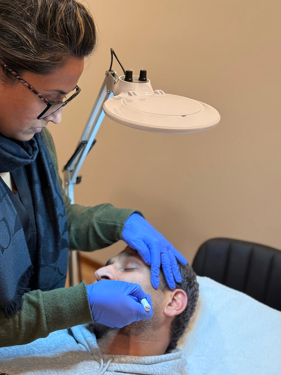 Laser Hair Removal Male 2