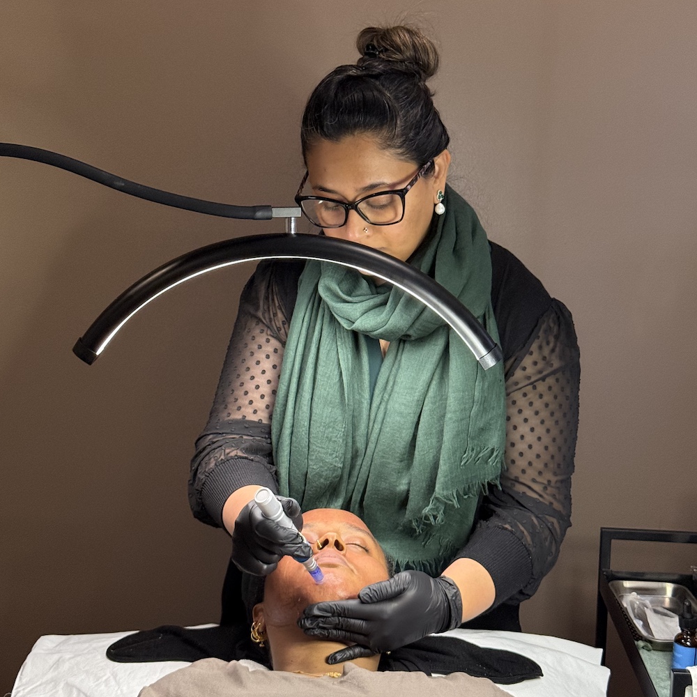 microneedle-treatment-auburn-wa