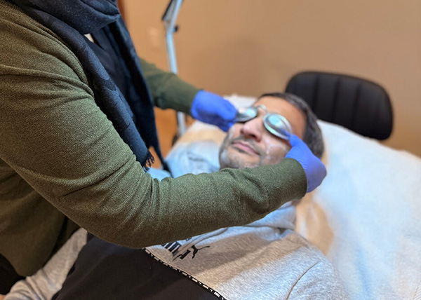 Laser Hair removal
