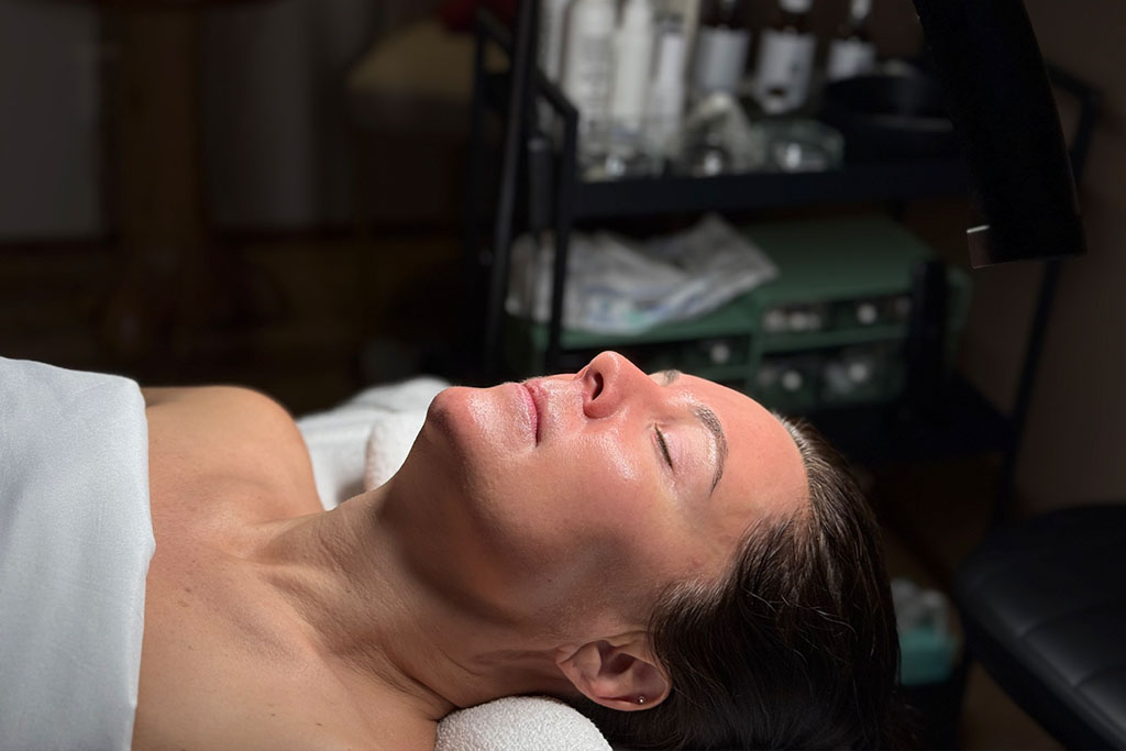 Understanding Chemical Peels for Skin Improvement