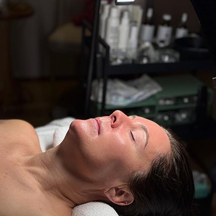 Chemical Peel
