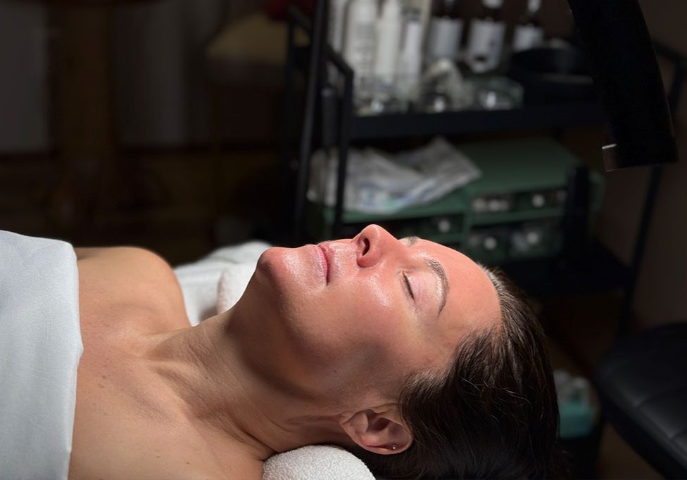 Understanding Chemical Peels for Skin Improvement